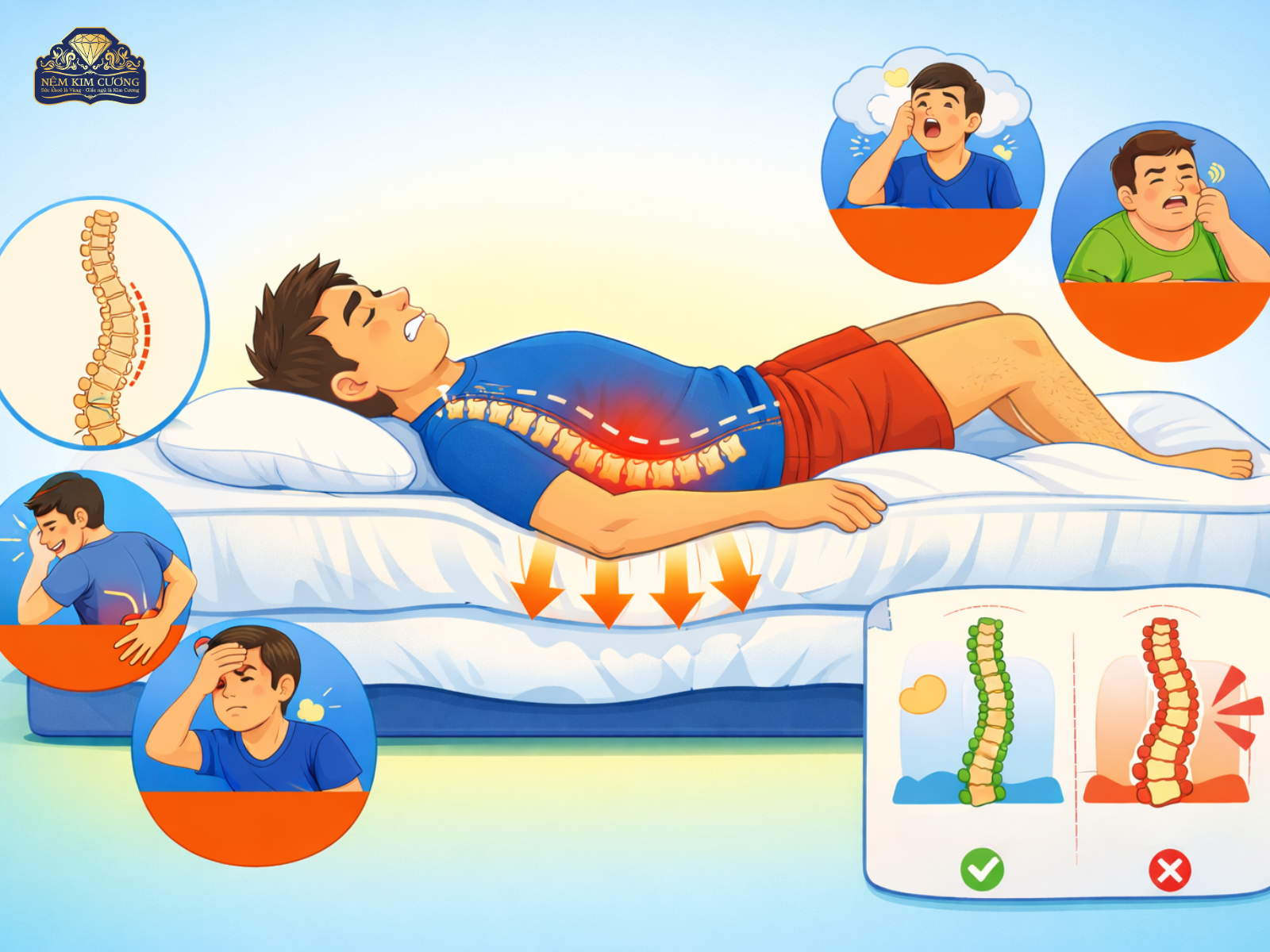 NẰM NỆM QUÁ MỀM GÂY ĐAU LƯNG: NGUYÊN NHÂN VÀ CÁCH KHẮC PHỤC TRIỆT ĐỂ